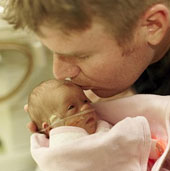 Premature babies weigh 720g