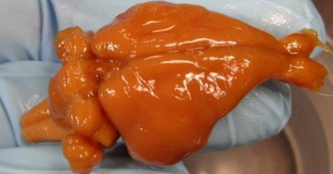 Preserving the brain perfectly with vitrification