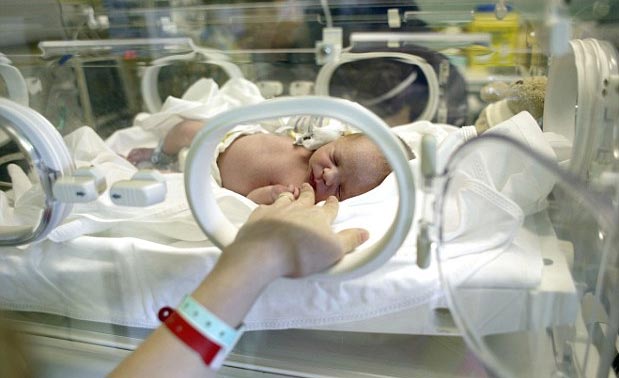Preterm birth changes a child's brain connection