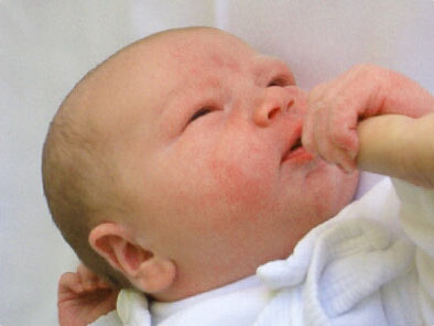 Preventing birth defects for babies