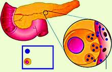 Prevention and treatment of chronic pancreatitis