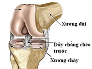 Previous cross ligament injury