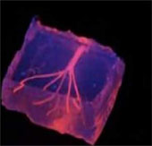 Print human blood vessels with 3D printers