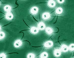 Producing hydrogen fuel from marine algae