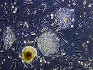Producing insulin from stem cells to treat diabetes
