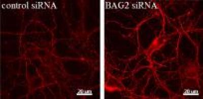 Progress in studying Alzheimer's