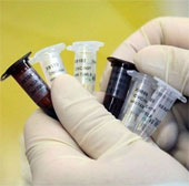 Promising breakthrough in research on cancer treatment vaccine