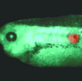 Prospects for early detection of cancer by bioelectric signals