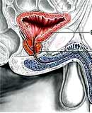 Prostate cancer does not necessarily need surgery