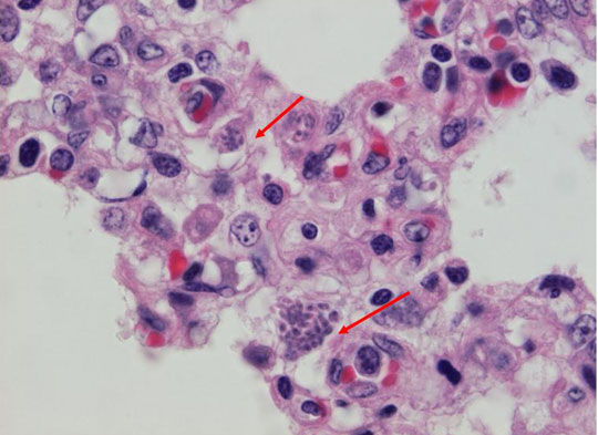 Protein helps parasites live in host cells