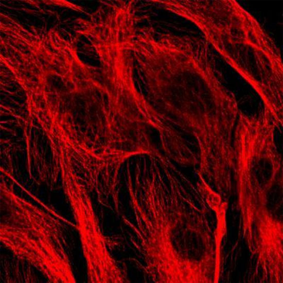 Protein supports the treatment of degenerative brain cells