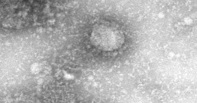 Publish the first image of the Corona virus