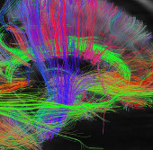 Published a map of human brain