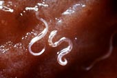 Put parasitic worms on yourself