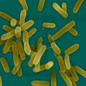 Quick diagnosis of pulmonary tuberculosis