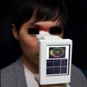Quick eye check with handheld scanner