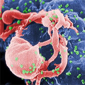 Radioactive bombs can kill HIV