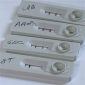 Rapid test equipment for leprosy