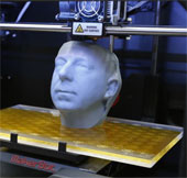 Reconstruction of titanium pelvis thanks to 3D printing technology