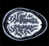 Recreate images in thinking through brain capture