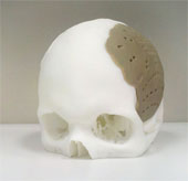 Recreate parts of the body with 3D printing technology