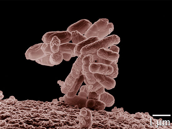 'Redesign of E. coli bacteria to prevent green pus bacilli