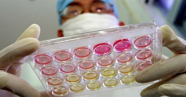 Research: Corona virus may have been transmitted to humans for decades