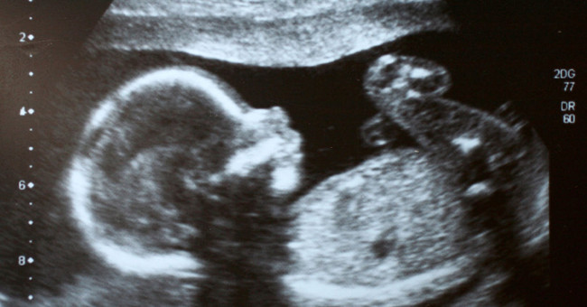 Research found vitamin B3 helps reduce miscarriage, birth defects
