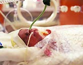 Respiratory depression in newborns