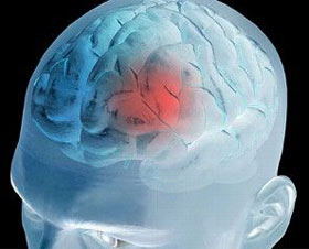 Restore brain activity by reducing pain