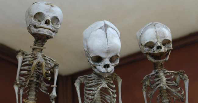 Reveal about 6 cases of using the body of a donor
