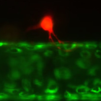 Reveal how cancer cells metastasize in the human body