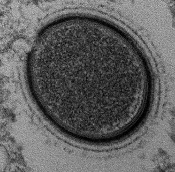 Revived ancient virus 30,000 years old