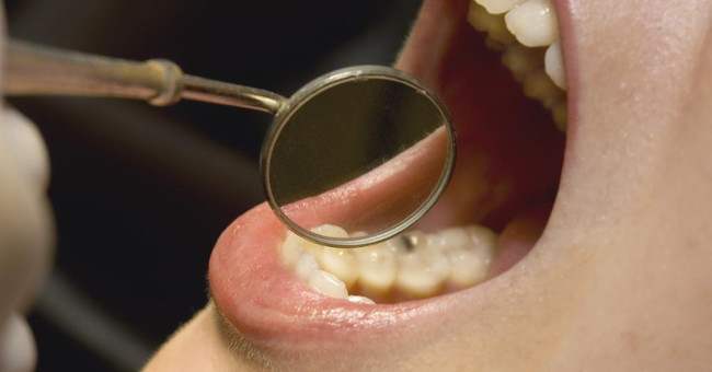 Risk of cancer in people with gum disease