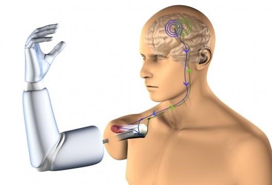 Robot arm for people with paralysis