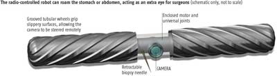 Robot probe abdomen people