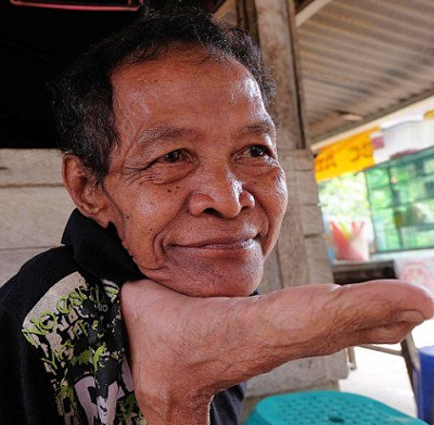 'Rubber people' have the ability to drink plastic like snakes