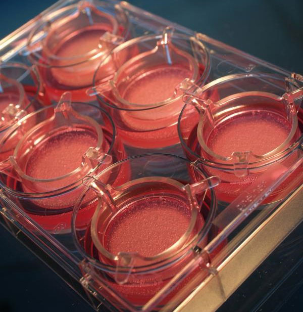 Russia produces artificial skin for burns and eye diseases