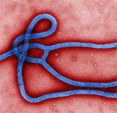 Russia warned of the risk of Ebola as a biological weapon