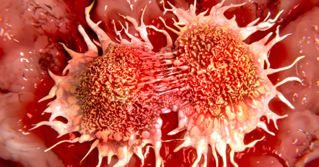Russian and Swedish scientists have found a way to kill cancer cells