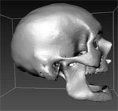Scanning the skull of a human skull to serve forensic medicine