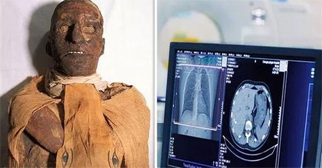 Scans of 3,000-year-old Egyptian pharaoh mummies, uncovering stunned secrets