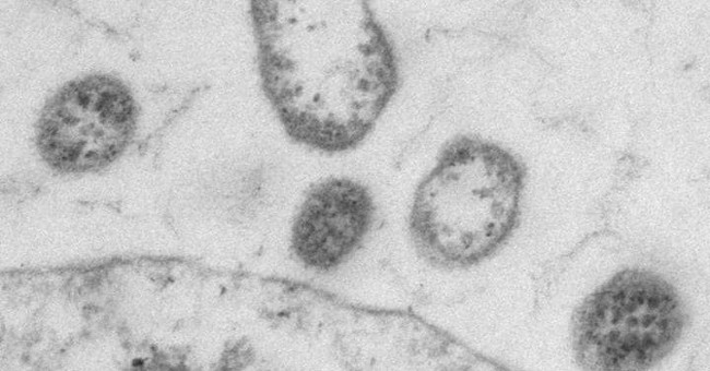 Science makes a virus that kills cancer cells, a major turning point for mankind?
