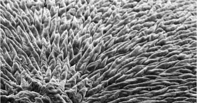 Scientists develop materials that can regenerate tooth enamel