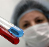 Scientists developed methods for rapid testing of influenza viruses
