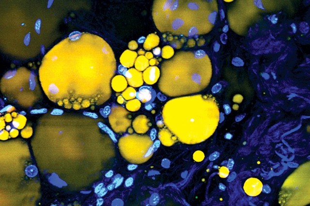 Scientists find three ways to turn human cells into lasers