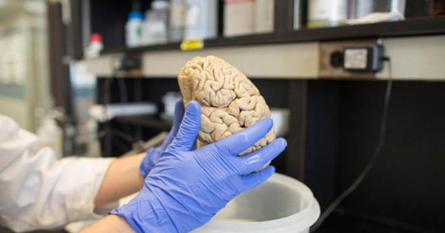 Scientists have found a way to completely prevent brain cancer