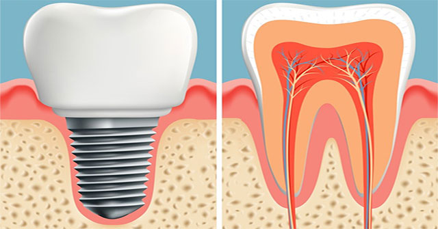 Scientists have found a way to help you regrow new teeth after only 2 months