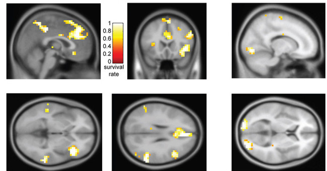 Scientists say brain scanners can identify what is a crime