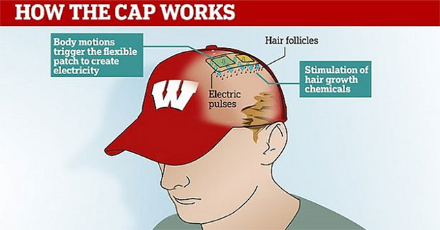 Scientists successfully developed bald anti-bald hat